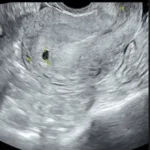 amanda_manopo-20251125-001-non_fotografer_kly