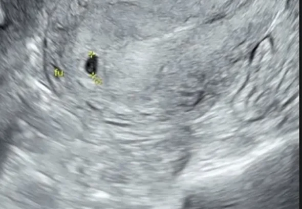 amanda_manopo-20251125-001-non_fotografer_kly