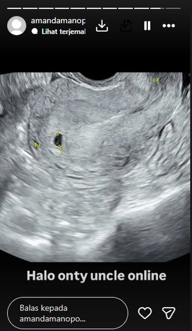 amanda_manopo-20251125-001-non_fotografer_kly